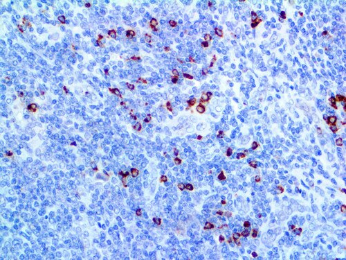 IHC of Granzyme B on an FFPE Spleen Tissue